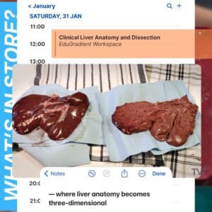 Session 1 (10:30–12:30) – Clinical Liver Anatomy with Dissection  | 31st January